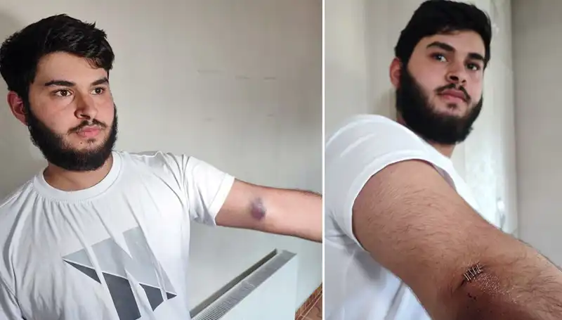 Bahçeye Kaçan Top, Mahallede Büyük Kaosa Yol Açtı!