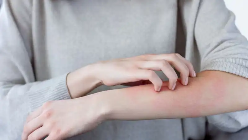 Cilt Kanseri Belirtilerini Gözden Kaçırmayın: Dermatologtan 2 Kritik Uyarı